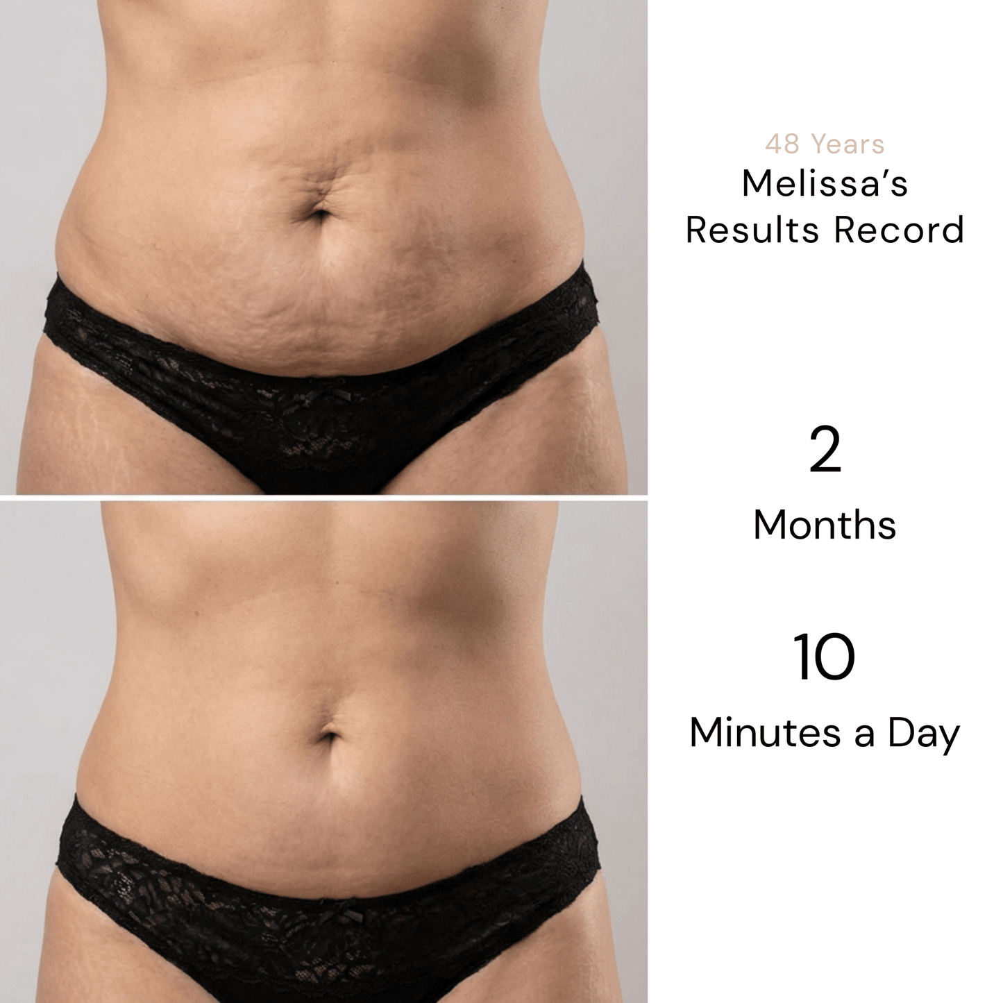 NuvéaSculpt Contour Pro